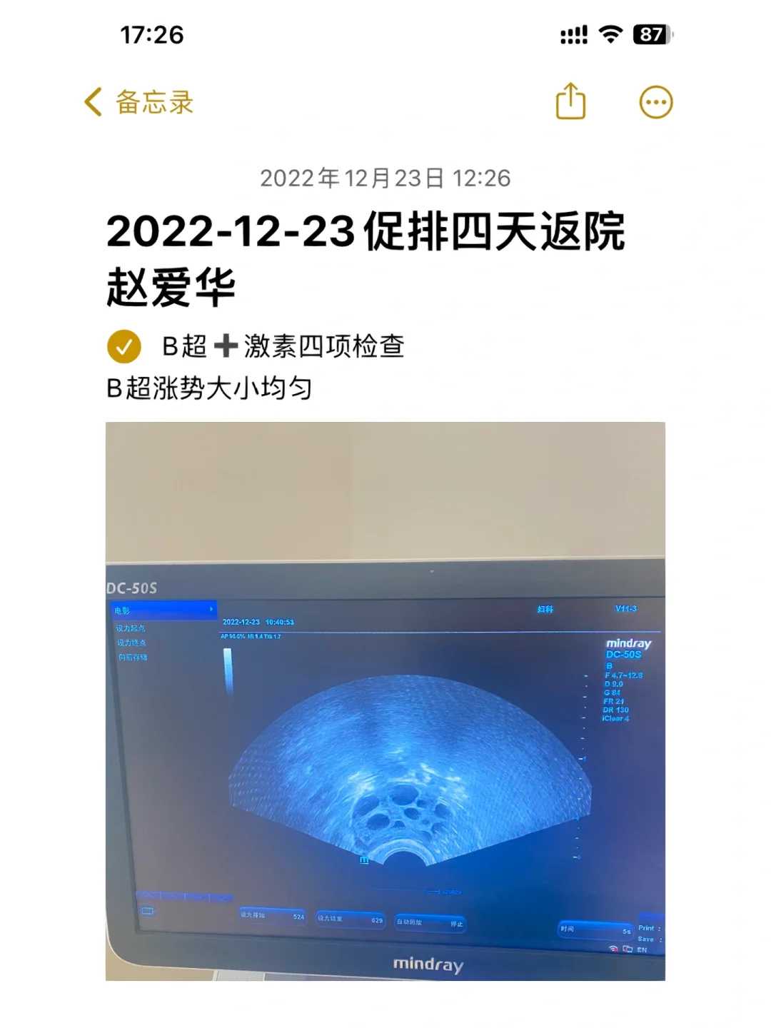 重庆高龄女性人工授精成功率深度解析：辅助生殖助孕方案选择与策略